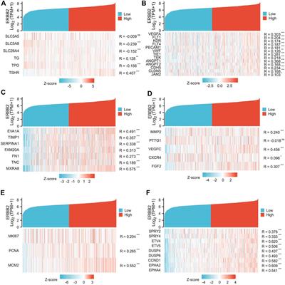 ERBB2 as a prognostic biomarker correlates with immune infiltrates in papillary thyroid cancer
